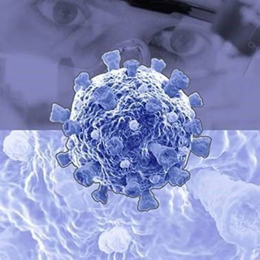 Oxford Immunotec Releases the TSPOT® Discovery™ SARSCoV2 Kit Lab Manager