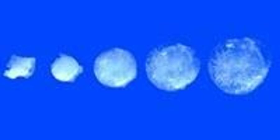 Quanto Tempo Impiega Una Pillola A Sciogliersi Nello Stomaco