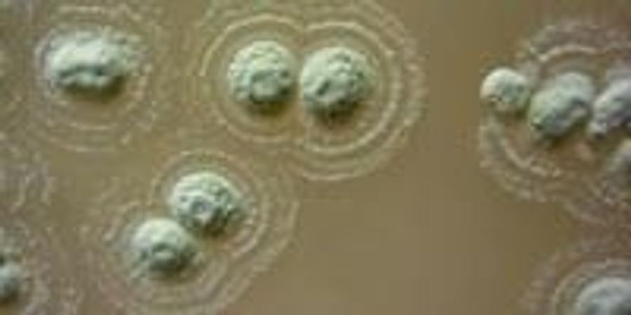 When is mrsa not contagious anymore picture