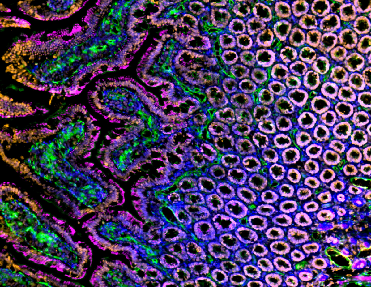 Immunofluorescent analysis of Sprague Dawley rat intestine, duodenum frozen sections with Histone H3 (orange), blood vessels (lectin, green), actin (magenta) and nuclei (blue) overlays. Tissues were labelled with Rabbit anti-Histone H3, Alexa Fluor Plus 555 F(ab’2) Goat anti-Rabbit (1:500), CellMask Deep Red Actin Tracking Stain (1:1000), Tomato Lectin DyLight 488 (1:100), and Hoechst (1:8000), and mounted with ProLong Gold Antifade Mountant. Imaged on an EVOS M7000 Imaging system. Immunofluorescent analysis of Sprague Dawley rat intestine, duodenum frozen sections with Histone H3 (orange), blood vessels (lectin, green), actin (magenta) and nuclei (blue) overlays. Tissues were labelled with Rabbit anti-Histone H3, Alexa Fluor Plus 555 F(ab’2) Goat anti-Rabbit (1:500), CellMask Deep Red Actin Tracking Stain (1:1000), Tomato Lectin DyLight 488 (1:100), and Hoechst (1:8000), and mounted with ProLong Gold Antifade Mountant. Imaged on an EVOS M7000 Imaging system.