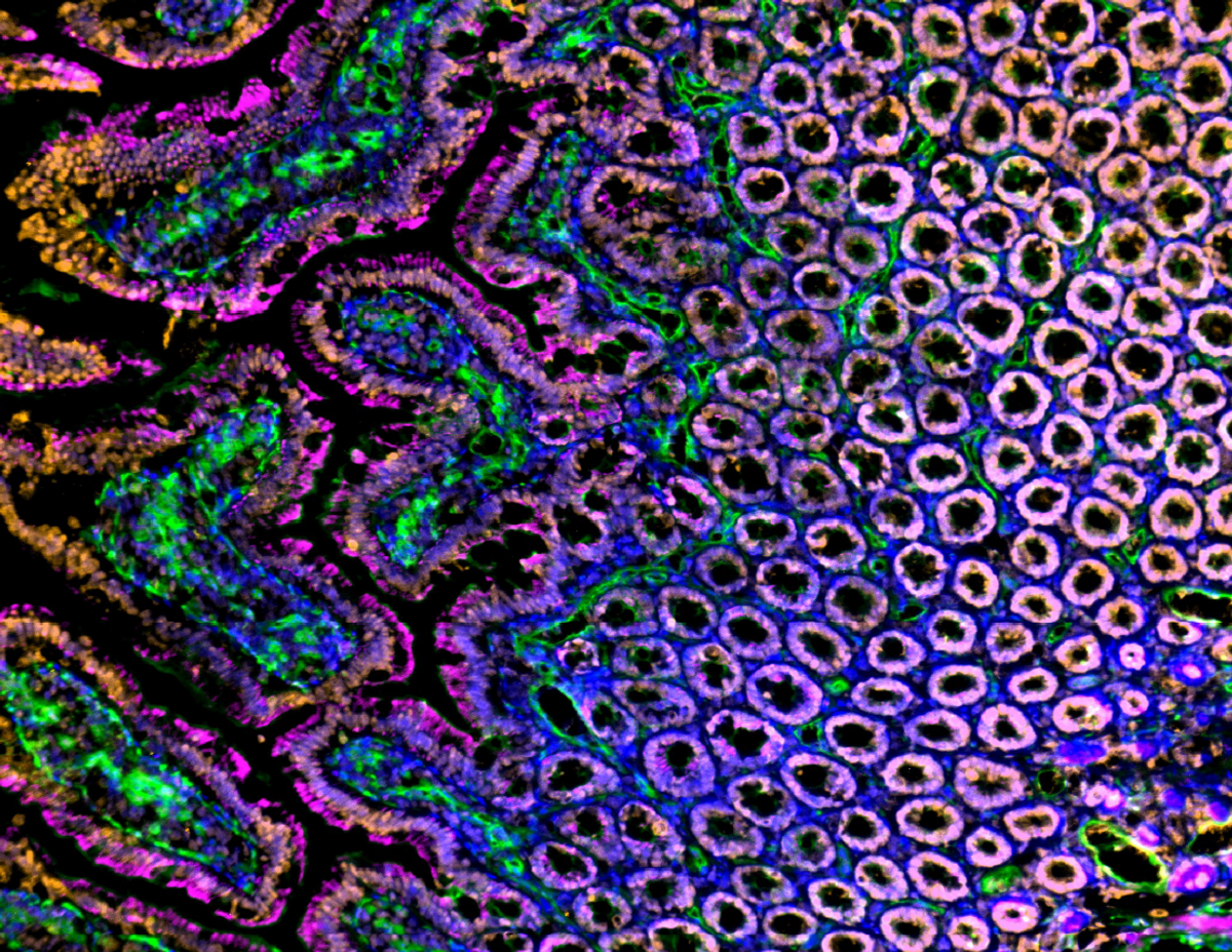 Immunofluorescent analysis of Sprague Dawley rat intestine, duodenum frozen sections with Histone H3 (orange), blood vessels (lectin, green), actin (magenta) and nuclei (blue) overlays. Tissues were labelled with Rabbit anti-Histone H3, Alexa Fluor Plus 555 F(ab’2) Goat anti-Rabbit (1:500), CellMask Deep Red Actin Tracking Stain (1:1000), Tomato Lectin DyLight 488 (1:100), and Hoechst (1:8000), and mounted with ProLong Gold Antifade Mountant.  Imaged on an EVOS M7000 Imaging system.