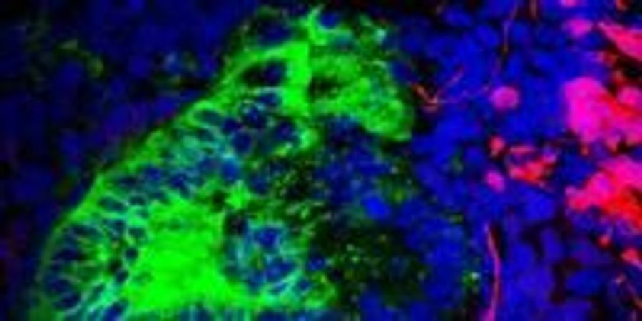 Wayward cells essay 08 image