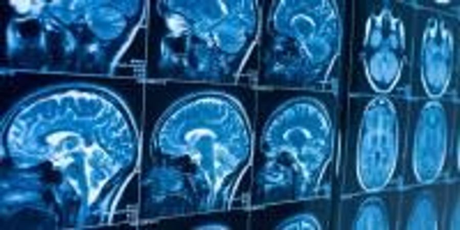 How Can Stress Cause Anxiety Blame The Brain s Cannabis Lab Manager